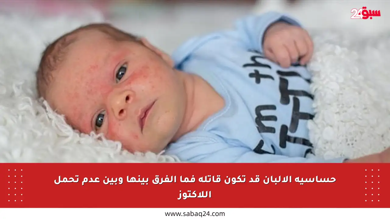 حساسية الألبان قد تكون قاتلة فما الفرق بينها وبين عدم تحمل اللاكتوز